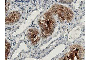 Immunohistochemistry (IHC) image for anti-Aldolase B, Fructose-Bisphosphate (ALDOB) antibody (ABIN1496605) (ALDOB antibody)