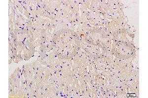 Formalin-fixed and paraffin embedded mouse myocardium labeled with Anti-Myoglobin Polyclonal Antibody, Unconjugated (ABIN704381) at 1:200 followed by conjugation to the secondary antibody and DAB staining. (Myoglobin antibody  (AA 21-120))