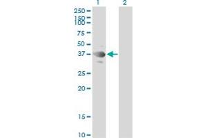 Western Blot analysis of TSSK2 expression in transfected 293T cell line by TSSK2 monoclonal antibody (M01), clone 1E12.