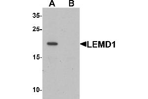 Western blot analysis of LEMD1 in A20 cell lysate with LEMD1 antibody at 1 µg/mL in (A) the absence and (B) the presence of blocking peptide.