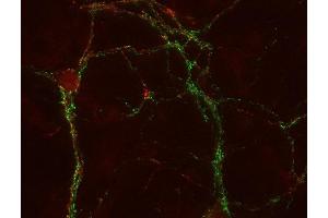 Indirect immunostaining of PFA fixed cultured hippocampus neurons with anti-SV2 C (dilution 1 : 500; red) and mouse anti-synapsin 1 (cat. (SV2C antibody)