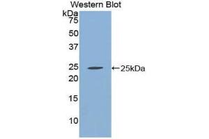 Western Blotting (WB) image for anti-Chromogranin B (Secretogranin 1) (CHGB) (AA 496-669) antibody (ABIN1858399) (CHGB antibody  (AA 496-669))