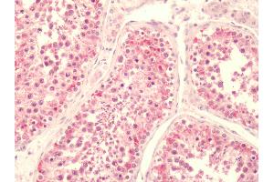 Human, Testis: Formalin-Fixed Paraffin-Embedded (FFPE) (LPAR5 antibody  (C-Term))