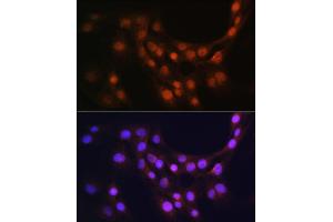 Immunofluorescence analysis of C6 cells using GMFB Rabbit pAb (ABIN6131732, ABIN6141181, ABIN6141182 and ABIN6224741) at dilution of 1:100 (40x lens). (GMFB antibody  (AA 1-140))