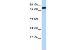 Western Blotting (WB) image for anti-Zinc Finger Protein 221 (ZNF221) antibody (ABIN2458181) (ZNF221 antibody)