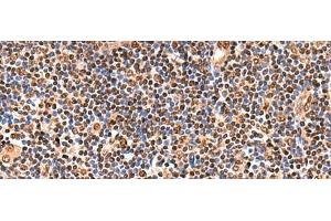Immunohistochemistry of paraffin-embedded Human tonsil tissue using GPKOW Polyclonal Antibody at dilution of 1:140(x200) (GPKOW antibody)