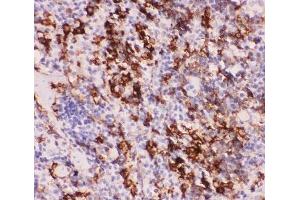IHC-P staining of mouse spleen tissue (MYD88 antibody  (AA 44-264))