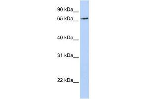 WB Suggested Anti-RNF139 Antibody Titration:  0.