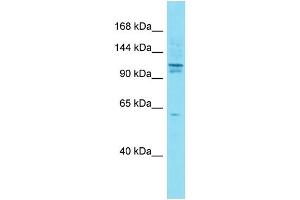 Host:  Rabbit  Target Name:  Axin1  Sample Type:  Mouse Testis lysates  Antibody Dilution:  1.