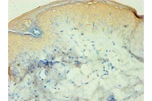 Immunohistochemistry of paraffin-embedded human skin tissue using ABIN7146502 at dilution of 1:100 (CALML5 antibody  (AA 1-146))