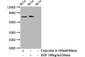 Western Blot Positive WB detected in Hela whole cell lysate(treated with Calyculin A or EGF) All lanes Phospho-RAF1 antibody at 1. (Recombinant RAF1 antibody  (pSer621))