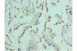 Immunohistochemistry of paraffin-embedded human prostate tissue using ABIN7152098 at dilution of 1:100 (Elf4 antibody  (AA 1-200))