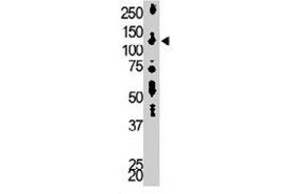 DGKD anticorps  (C-Term)