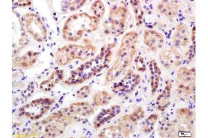Formalin-fixed and paraffin embedded human kidney labeled with Rabbit Anti Mitofusin 2/MFN2 Polyclonal Antibody, Unconjugated  at 1:200 followed by conjugation to the secondary antibody and DAB staining (MFN2 antibody  (AA 1-120))