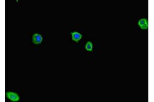 Immunofluorescent analysis of HepG2 cells using ABIN7143320 at dilution of 1:100 and Alexa Fluor 488-congugated AffiniPure Goat Anti-Rabbit IgG(H+L) (ADCY1 antibody  (AA 416-610))