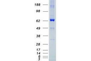 Validation with Western Blot