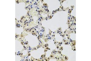 Immunohistochemistry of paraffin-embedded rat lung using GTF2H2 antibody (ABIN5975366) at dilution of 1/100 (40x lens). (GTF2H2 antibody)
