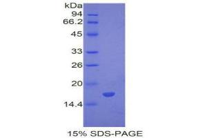 SDS-PAGE (SDS) image for Bone Morphogenetic Protein 7 (BMP7) (AA 292-430) protein (His tag) (ABIN1878294)