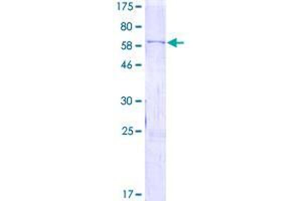 WIF1 Protein (AA 1-379) (GST tag)