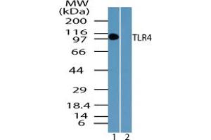 Image no. 1 for anti-Toll-Like Receptor 4 (TLR4) (AA 650-700) antibody (ABIN1491625) (TLR4 antibody  (AA 650-700))