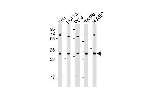 All lanes : Anti-TNFRSF6B Antibody (N-term) at 1:2000 dilution Lane 1: Hela whole cell lysate Lane 2: HC whole cell lysate Lane 3: PC-3 whole cell lysate Lane 4: S whole cell lysate Lane 5: HUVEC whole cell lysate Lysates/proteins at 20 μg per lane.
