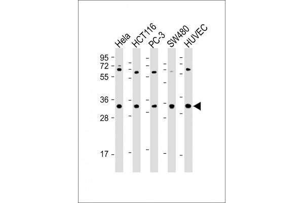 TNFRSF6B Antikörper  (N-Term)