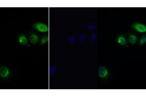 Detection of LEPR in Human Hela cell using Polyclonal Antibody to Leptin Receptor (LEPR) (Leptin Receptor antibody  (AA 310-539))