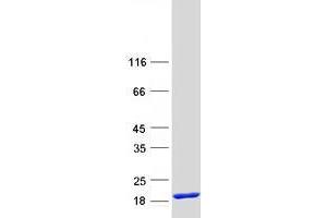 Validation with Western Blot (TRAPPC1 Protein (Myc-DYKDDDDK Tag))