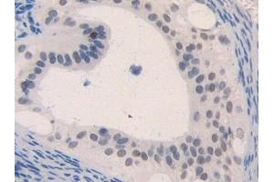 Detection of MIP1b in Mouse Ovary Tissue using Polyclonal Antibody to Macrophage Inflammatory Protein 1 Beta (MIP1b) (CCL4 antibody  (AA 24-92))