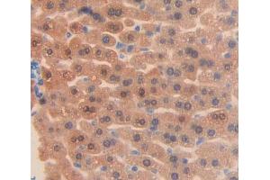 Used in DAB staining on fromalin fixed paraffin- embedded liver tissue (ABCF1 antibody  (AA 617-837))