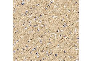 anti-Internexin Neuronal Intermediate Filament Protein, alpha (INA) (AA 62-169) antibody