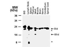 Western blot analysis of Bid in normal mouse tissues using Bid polyclonal antibody  at 1 : 2000.