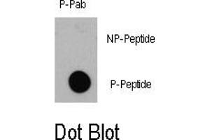 Image no. 1 for anti-Eukaryotic Translation Initiation Factor 4E Binding Protein 1 (EIF4EBP1) (pThr36) antibody (ABIN358355) (eIF4EBP1 antibody  (pThr36))