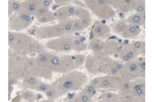 Detection of SMN2 in Human Liver Tissue using Polyclonal Antibody to Survival Of Motor Neuron 2, Centromeric (SMN2) (SMN2 antibody  (AA 16-251))
