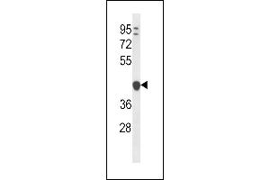 YIPF1 Antibody (N-term) (ABIN656786 and ABIN2846004) western blot analysis in ZR-75-1 cell line lysates (35 μg/lane). (YIPF1 antibody  (N-Term))