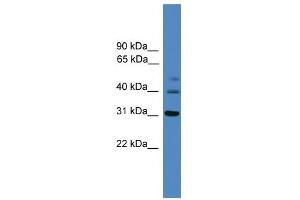 WB Suggested Anti-TRIB1 Antibody Titration: 0. (TRIB1 antibody  (C-Term))