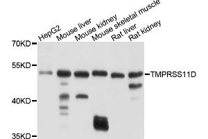 Western blot analysis of extracts of various cell lines, using TMPRSS11D antibody (ABIN4905444) at 1:1000 dilution. (TMPRSS11D antibody)