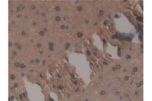 Detection of TNP1 in Mouse Liver Tissue using Polyclonal Antibody to Transition Protein 1 (TNP1) (TNP1 antibody  (AA 3-53))