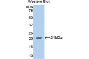 Detection of Recombinant SPTAN1, Human using Polyclonal Antibody to Alpha-Fodrin (SPTAN1) (SPTAN1 antibody  (AA 1573-1742))