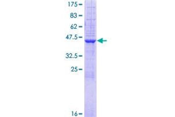 ST6GAL1 Protein (AA 1-175) (GST tag)