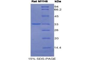 SDS-PAGE of Protein Standard from the Kit (Highly purified E. (MYH6 ELISA Kit)