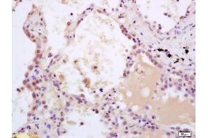 Immunohistochemistry (IHC) image for anti-SHC (Src Homology 2 Domain Containing) Transforming Protein 1 (SHC1) (pTyr349), (pTyr350) antibody (ABIN745973)