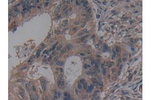 Immunohistochemistry (IHC) image for anti-Anoctamin 6 (ANO6) (AA 744-824) antibody (ABIN7436141)