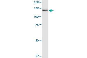 IGSF1 monoclonal antibody (M01), clone 4C7. (IGSF1 antibody  (AA 220-310))