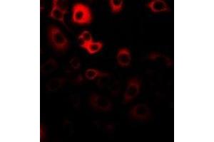 Immunofluorescent analysis of RANBP5 staining in Hela cells. (Importin 5 antibody)