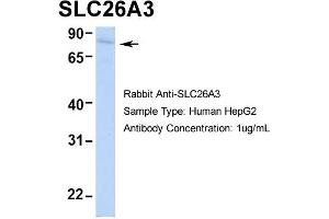 Host: Rabbit Target Name: SLC26A3 Sample Type: HepG2 Antibody Dilution: 1. (SLC26A3 antibody  (Middle Region))