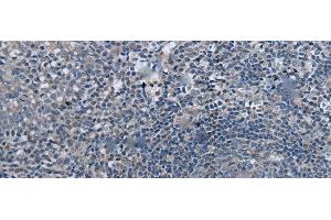 Immunohistochemistry of paraffin-embedded Human tonsil tissue using UBR4 Polyclonal Antibody at dilution of 1:55(x200) (UBR4 antibody)