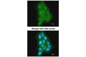 ICC/IF Image Immunofluorescence analysis of paraformaldehyde-fixed A431, using MAGEA11, antibody at 1:500 dilution. (MAGEA11 antibody  (N-Term))