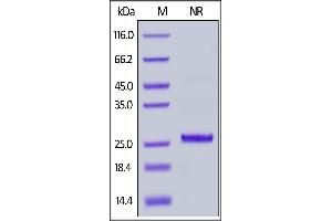 Rhesus macaque / Cynomolgus Complement Factor D, His Tag on  under ing (NR) condition. (Adipsin Protein (AA 26-253) (His tag))