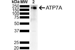 Western Blotting (WB) image for anti-ATPase, Cu++ Transporting, alpha Polypeptide (ATP7A) (AA 42-61) antibody (HRP) (ABIN2485193)